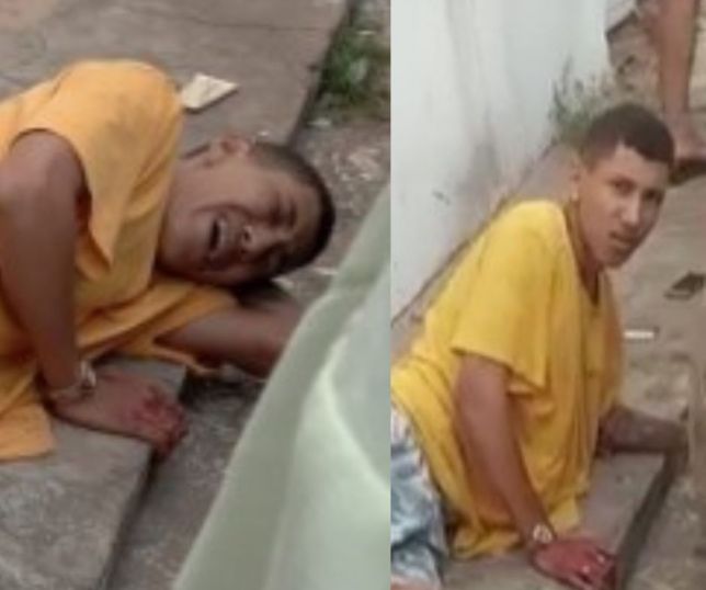 Notícias IMAGENS FORTES Assaltante parte da perna amputada